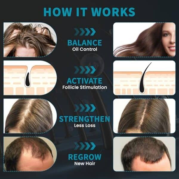 Découvrez le casque iKeener, une solution révolutionnaire de luminothérapie pour lutter contre la chute des cheveux. Augmentez votre volume capillaire grâce à cette innovation anti-chute efficace et testée.